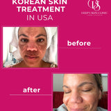 Deep’s Beauty Detox Whitening Night Pack - Deep’s Skin Clinic