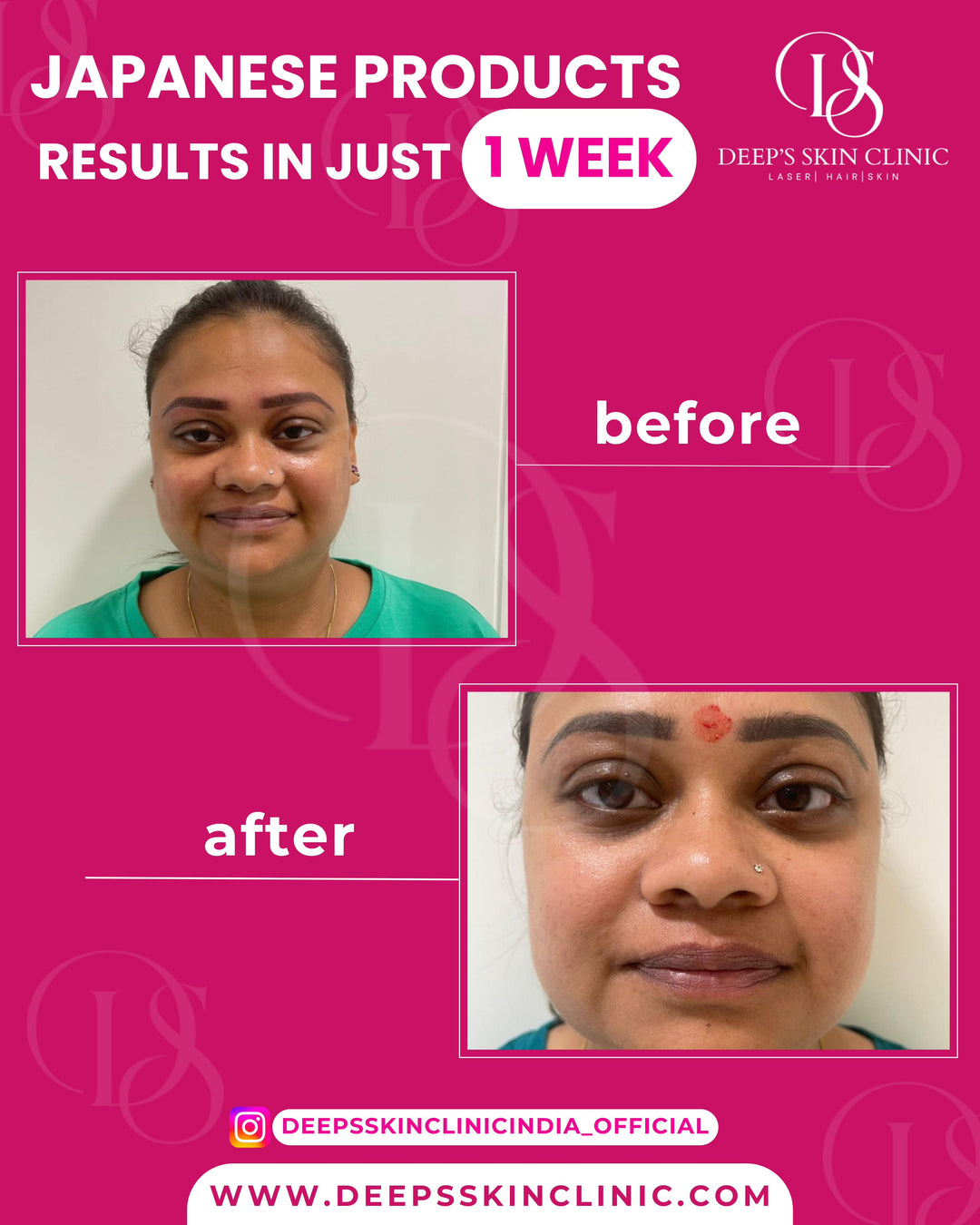 Japanese Pigmentation & Dark Spot Correction Cream – Day cream