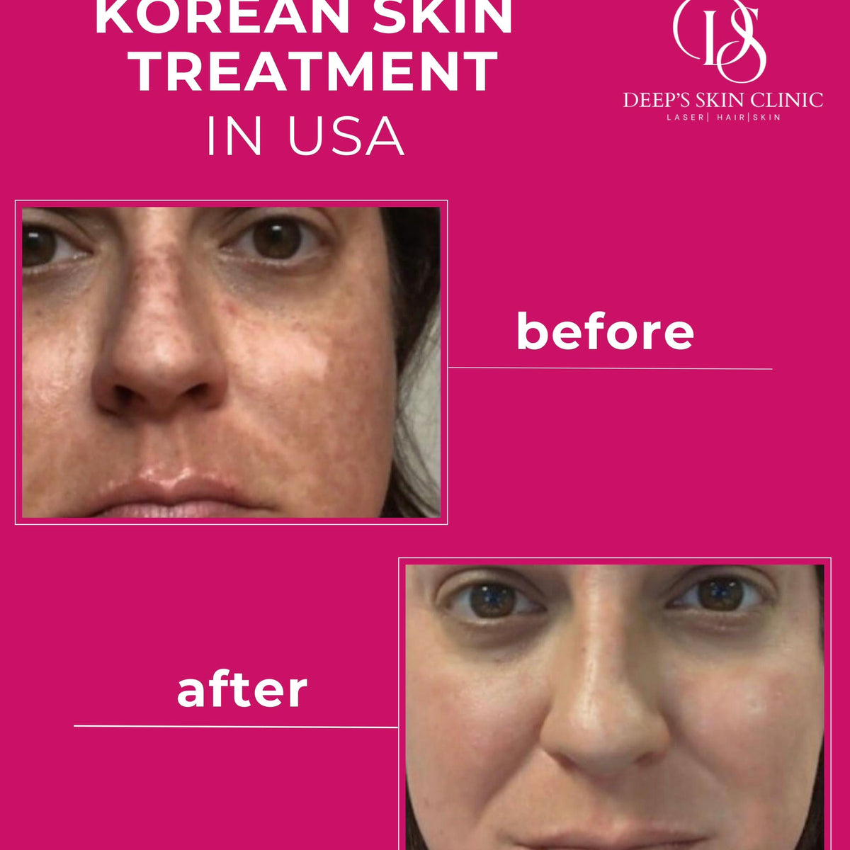 Deep’s Beauty Detox Whitening Night Pack - Deep’s Skin Clinic