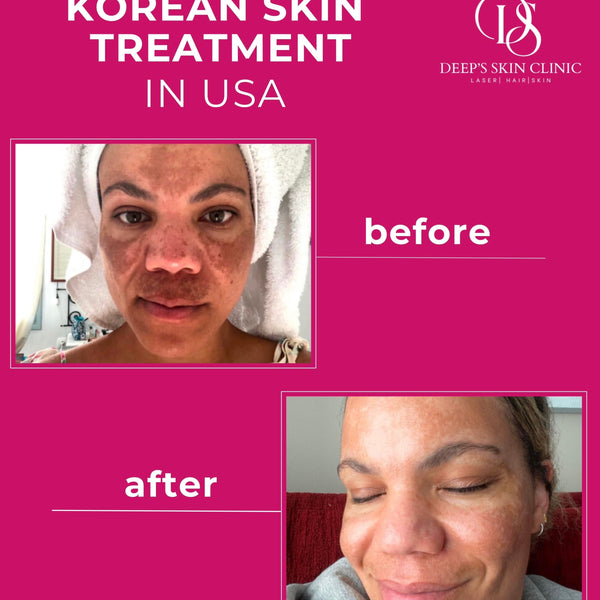 Deeps Beauty Cosmetics - Korean Whitening Night Cream - Deep’s Skin Clinic