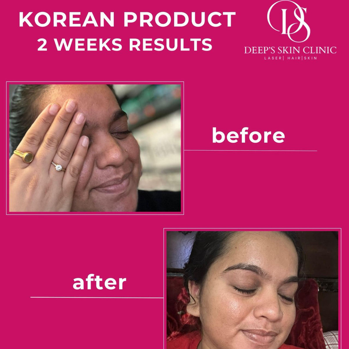 Deeps Beauty Cosmetics - Korean Whitening Night Cream - Deep’s Skin Clinic