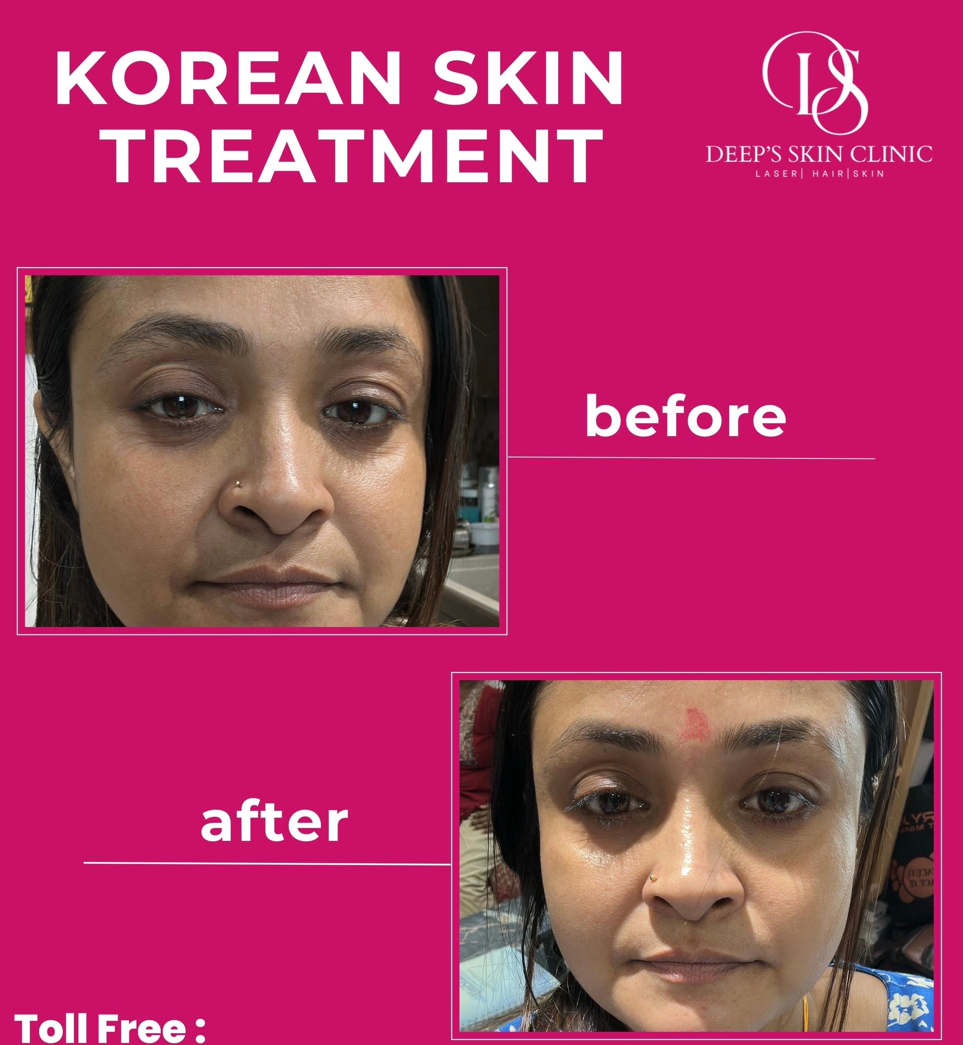 Deeps Beauty – Korean Brightening Serum-30Ml - Deep’s Skin Clinic