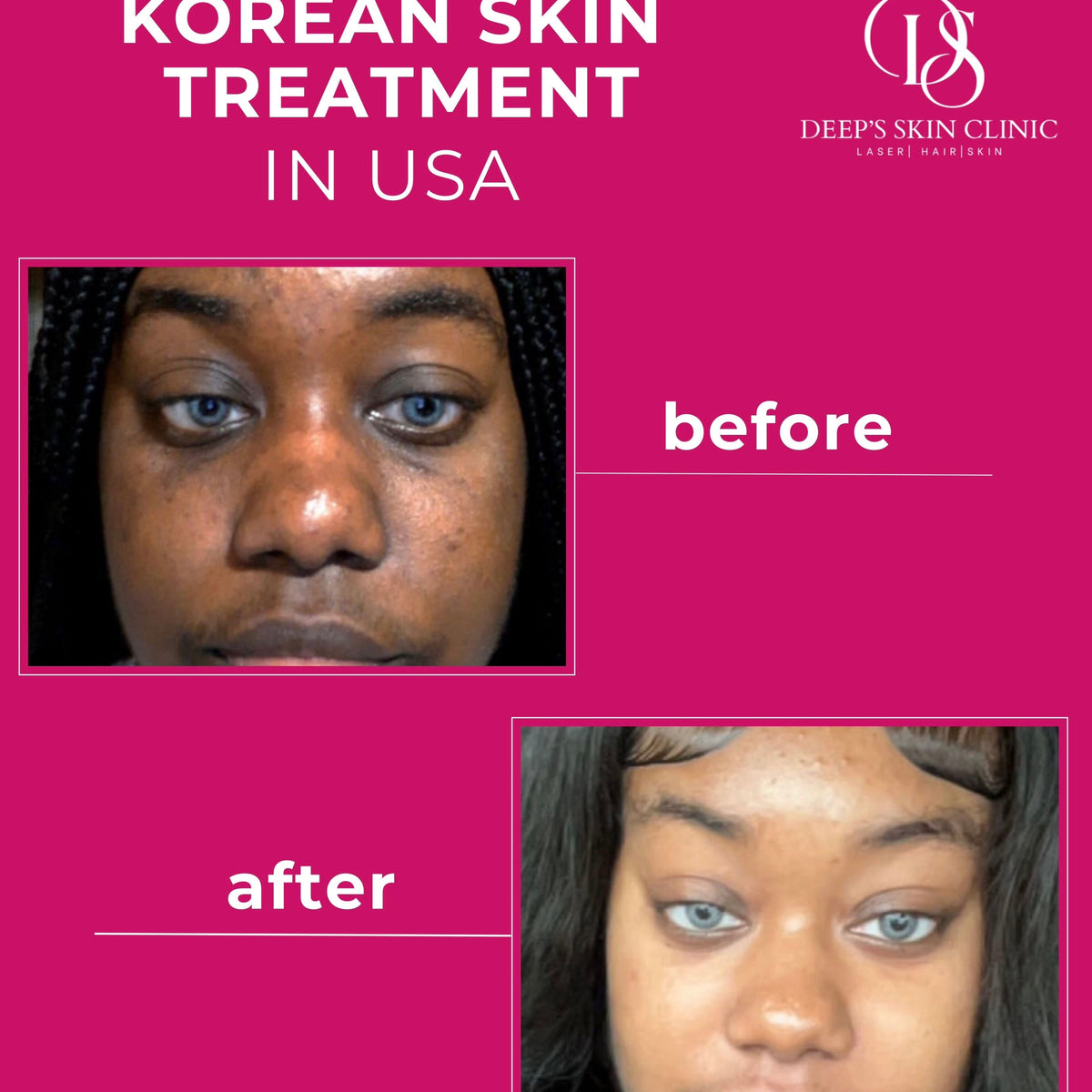 Deep’s Beauty Detox Whitening Night Pack - Deep’s Skin Clinic