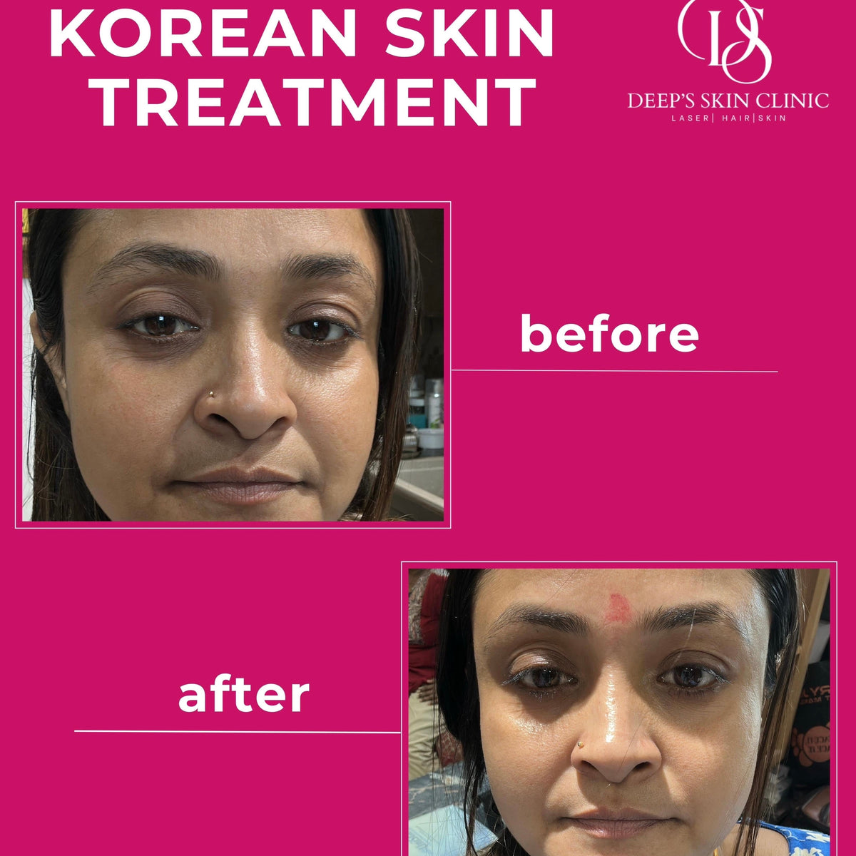 Deeps Beauty Cosmetics - Korean Whitening Night Cream - Deep’s Skin Clinic