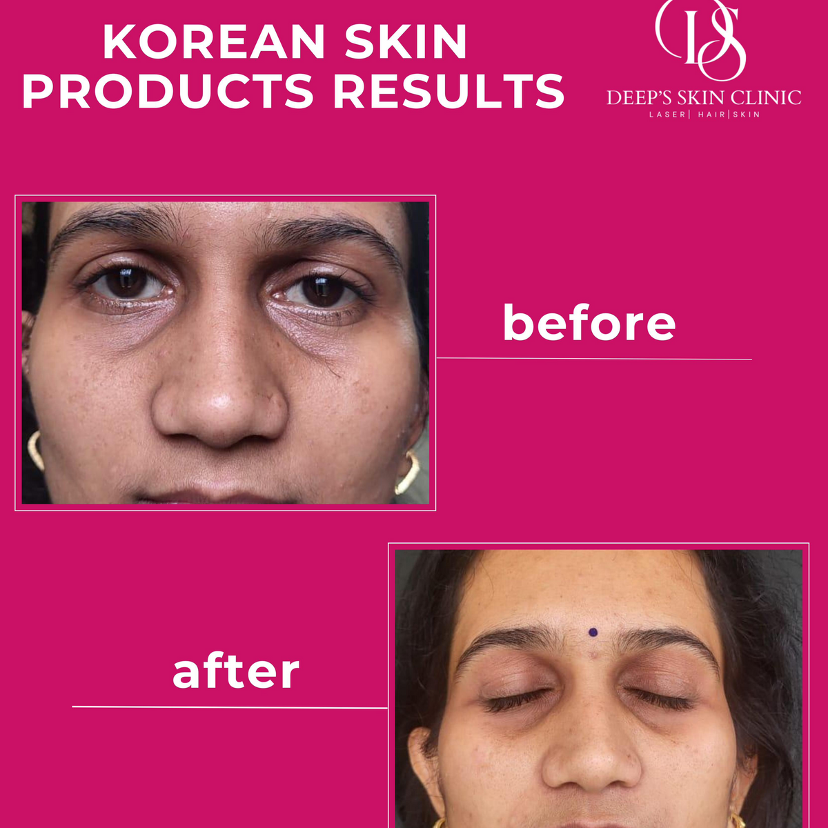 Whitening Combo pack - Deep’s Skin Clinic