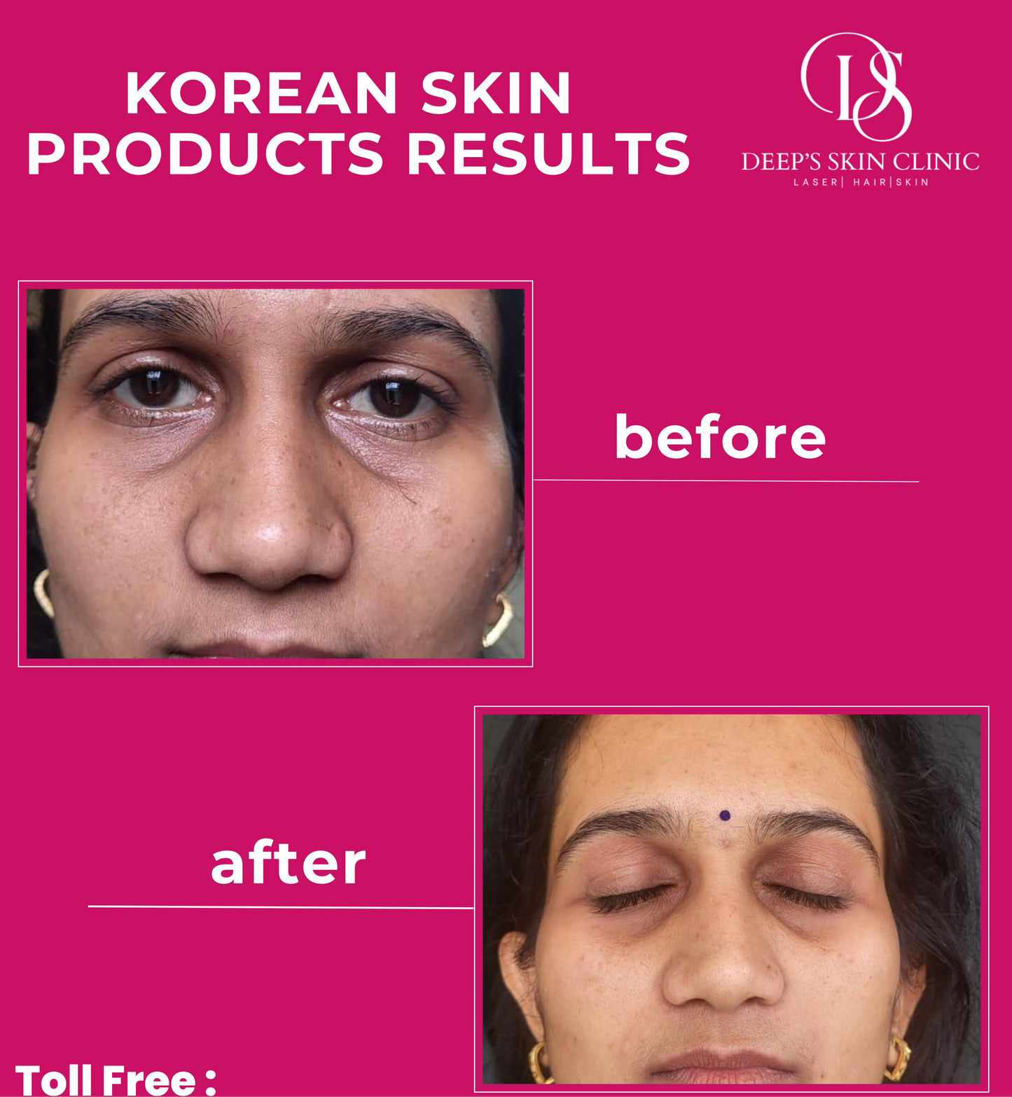 Whitening Combo pack - Deep’s Skin Clinic