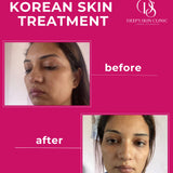 Whitening Combo pack - Deep’s Skin Clinic