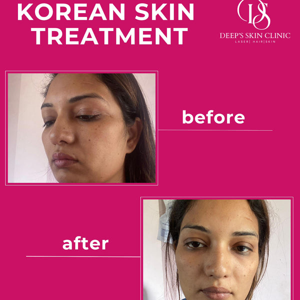 Whitening Combo pack - Deep’s Skin Clinic