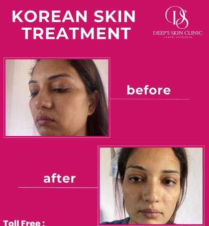 Whitening Combo pack - Deep’s Skin Clinic