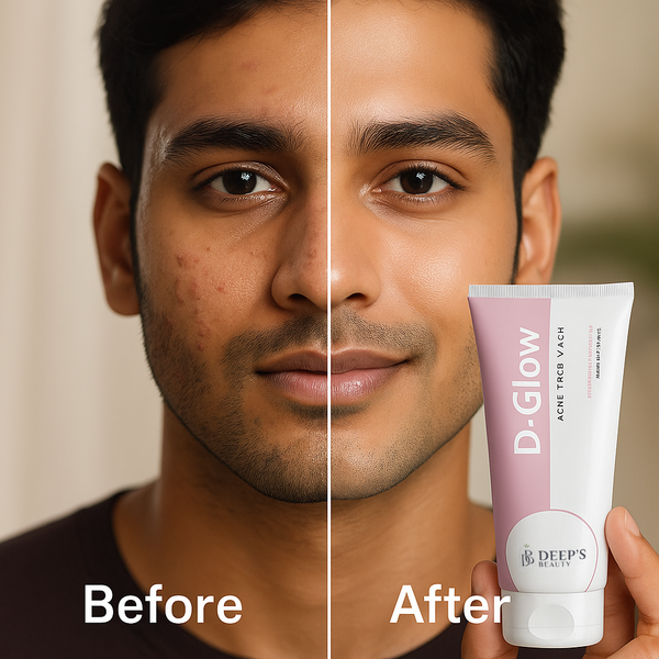 D Glow Acne Face Wash  | Fights Breakouts, Controls Oil & Fades Acne Scars |  Oily & Acne-Prone Skin | 100ml - Deep’s Skin Clinic