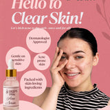 Acne Serum - Deep’s Skin Clinic
