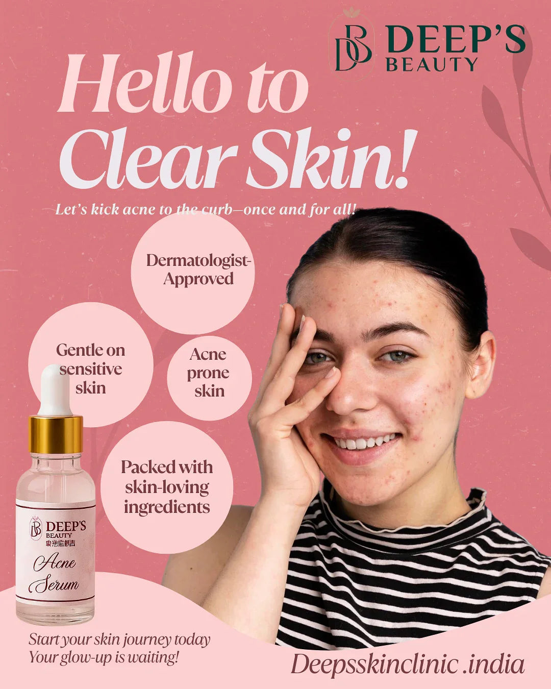Acne Serum - Deep’s Skin Clinic